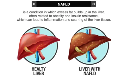 How the Modern Food Industry Fuels NAFLD and Metabolic Disorders