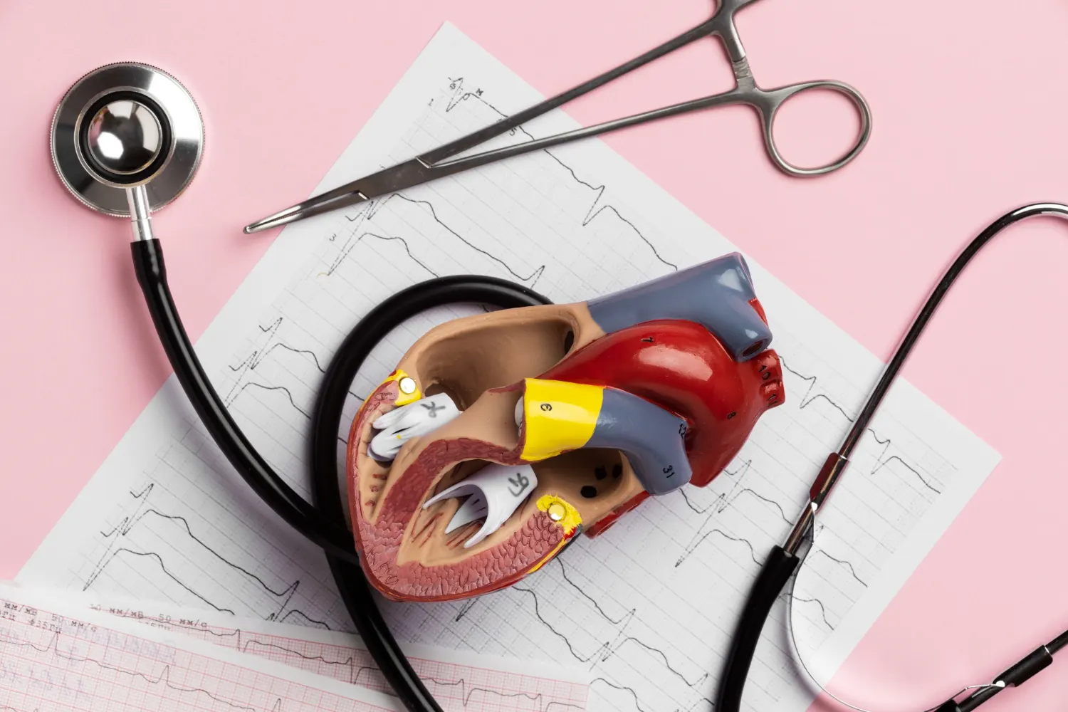atherosclerosis prevention