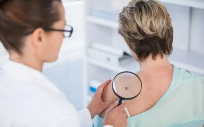 How to Identify Skin Cancer Early: A Clinically-Informed Guide