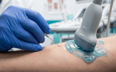 A Vibrating Ultrasound Needle Just Made Biopsies Smarter – and Far Less Frustrating