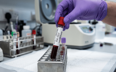 Finasteride and PSA Levels: What It Means for Prostate Cancer Screening